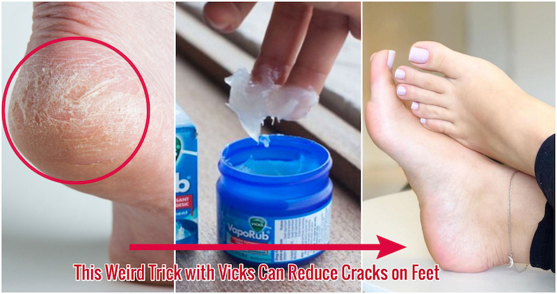 Discover the Surprising Benefits of Vicks Vaporub