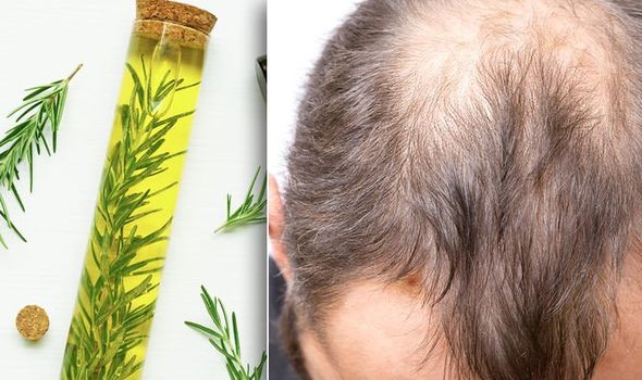 Using Rosemary for Hair Growth