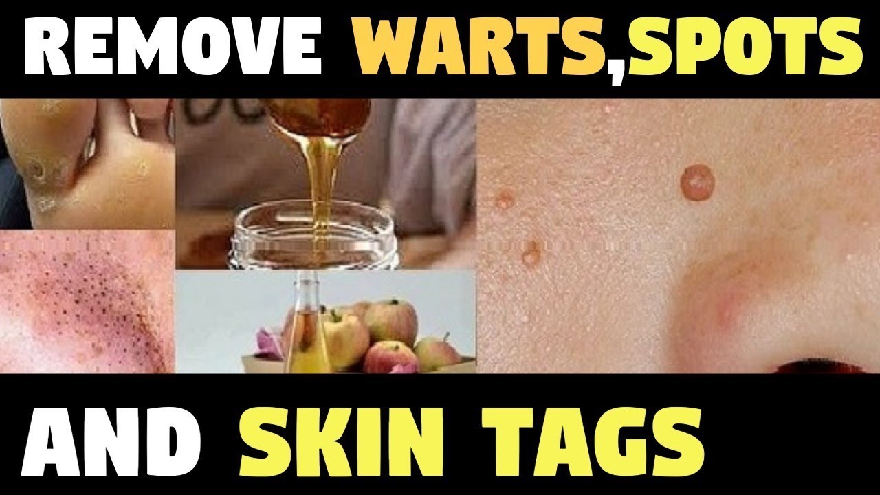 Get Rid Of Skin Problems Naturally