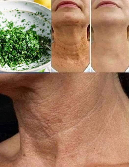 Unlock the Secret to Radiant Skin with a Homemade Parsley Mask