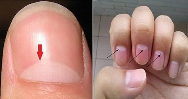 If You Have The Half Moon Shape On Your Nails, This Is What It Means.