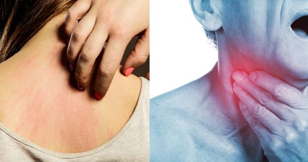 Early Warning Signs That Cancer Is Growing In Your Body