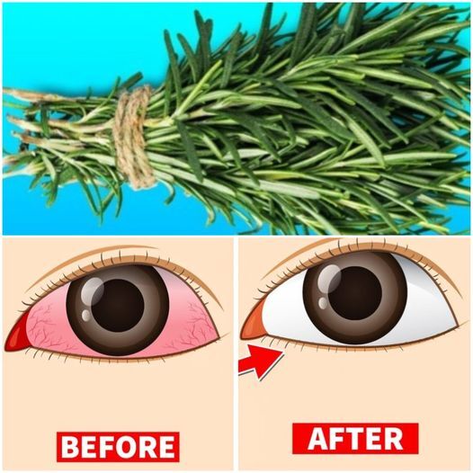 Seeing the World Through Greener Lenses: 7 Herbs for Eye Health and Vision Repair