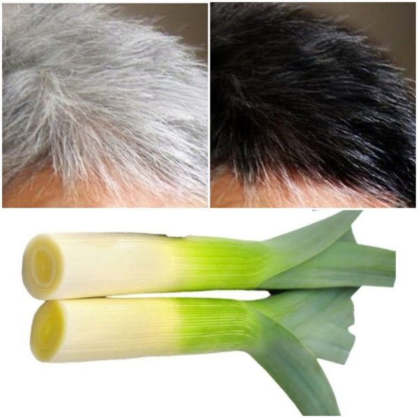 Gray Hair Remedies for Healthy and Vibrant Hair