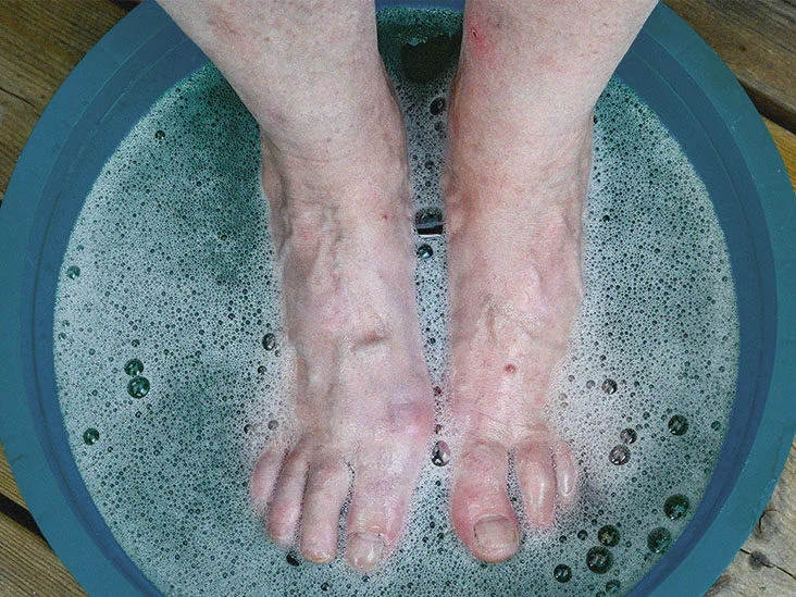 Ease Your Heel Pain with a Simple Baking Soda Solution