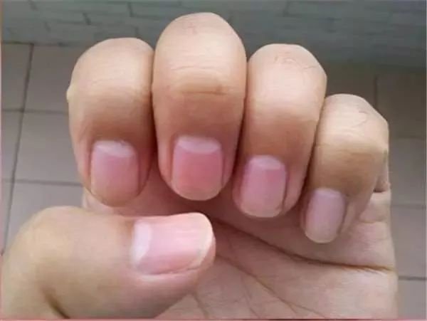 Understanding the Significance of the Crescent on Your Nails: A Health Indicator