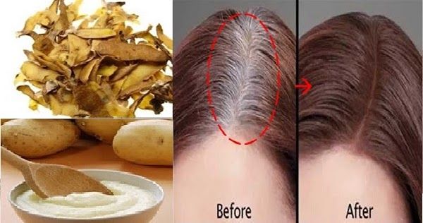 Say Goodbye to White Hair Forever with This Natural Remedy