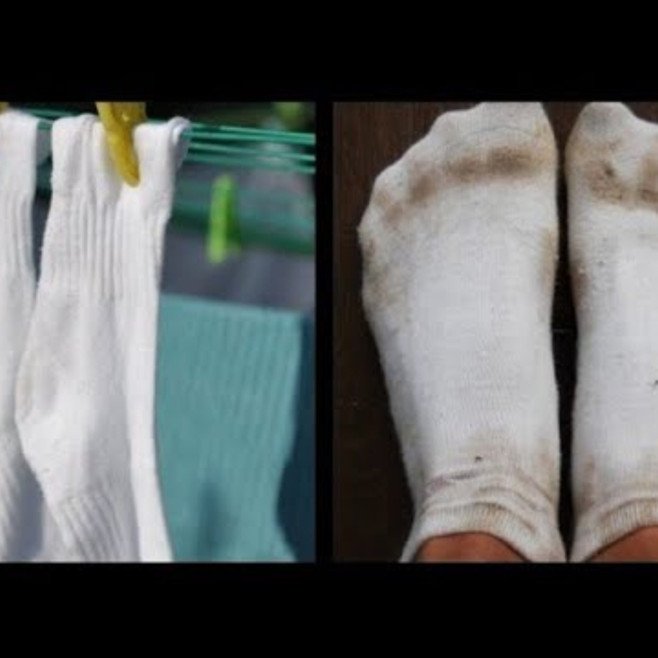 Keep Your Socks Sparkling White: A Simple Soaking Solution