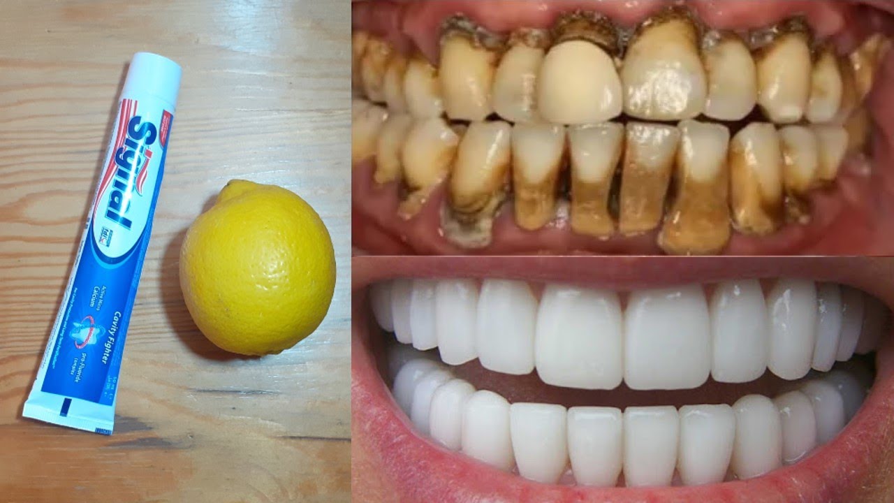 Brighten Your Smile with a Simple Homemade Toothpaste