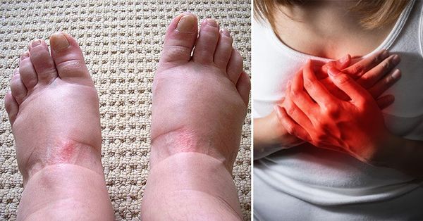 Warning Signs of Swollen Feet: What You Should Know