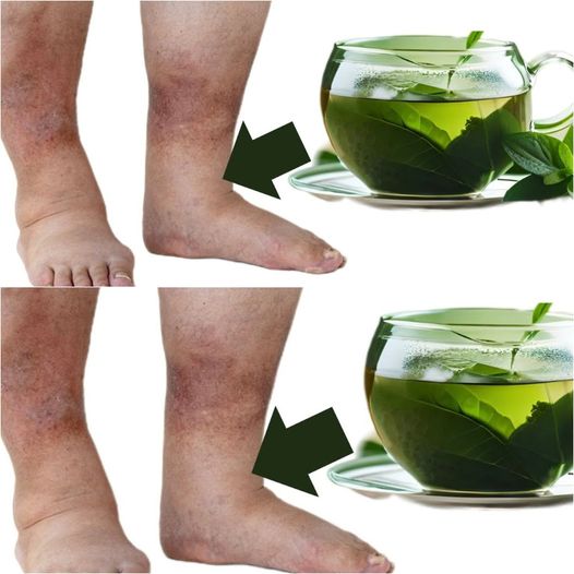 Miraculous TEA for Impressively Fast Removal of Swelling! Discover the Power of Nature…