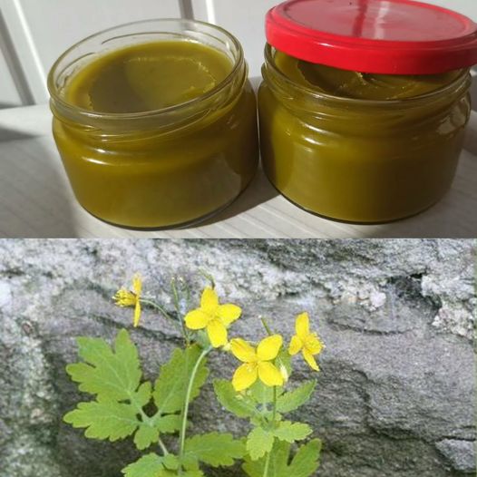 Miracle Ointment Made from Celandine: Good for Nail Fungus