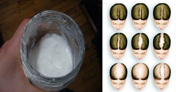 Baking Soda Shampoo: Boost Your Hair Growth Naturally