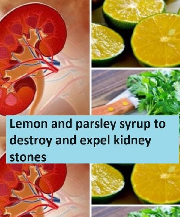 Lemon and Parsley Syrup for Kidney Stones