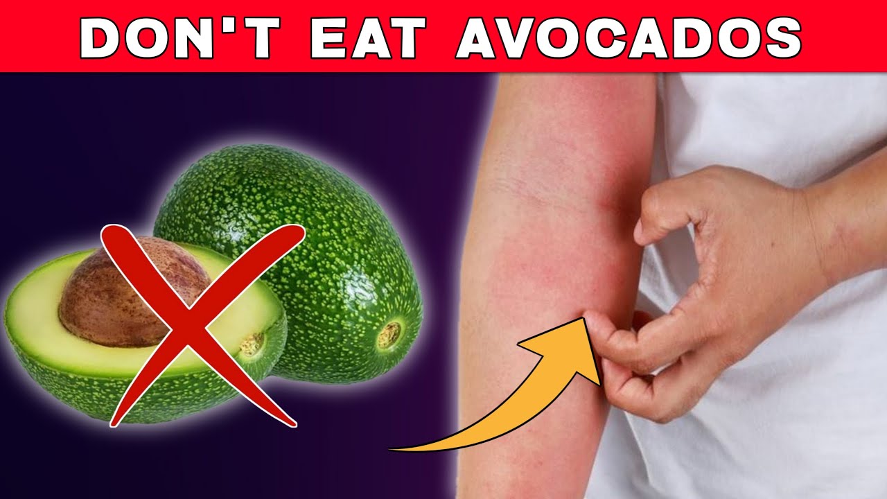 Navigating Avocado Consumption with Certain Health Conditions