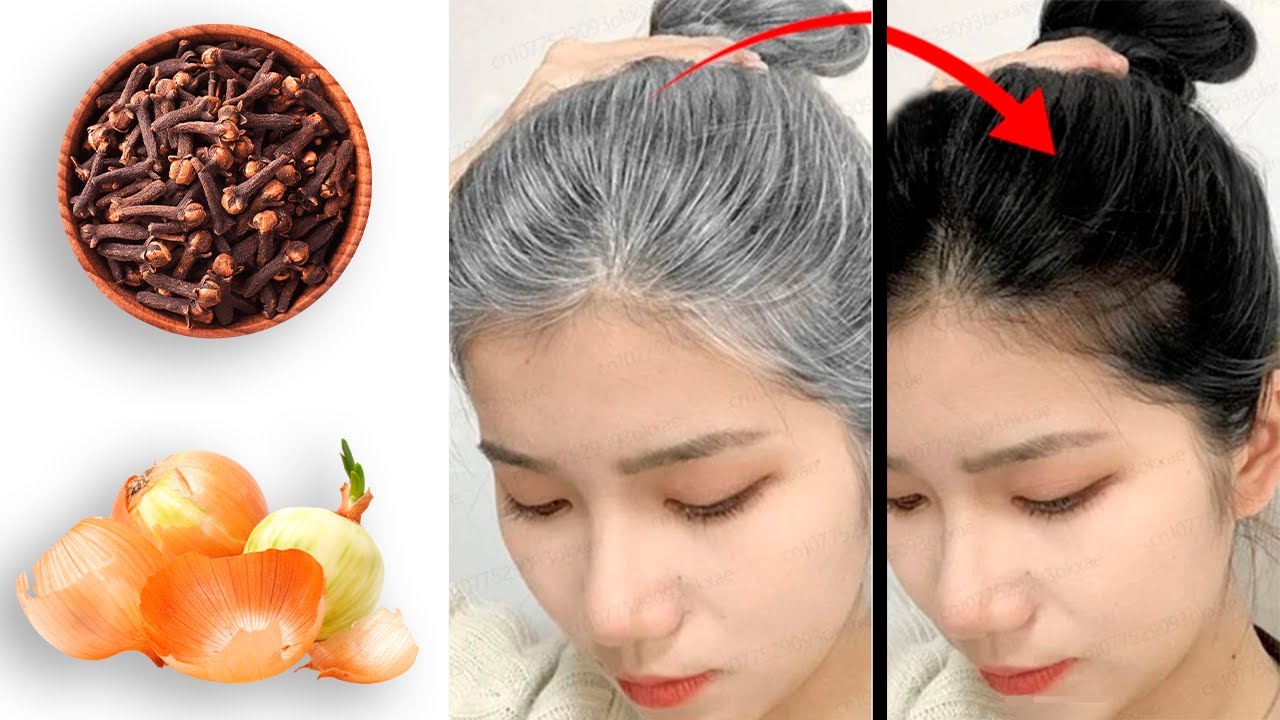 Discover the Surprising Benefits of Cloves and Onions for Hair