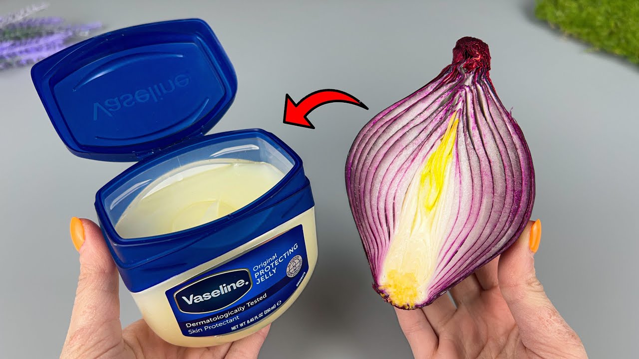 Mix Vaseline with Onion and You Will Be Shocked! If Only I Had Known About This Earlier!