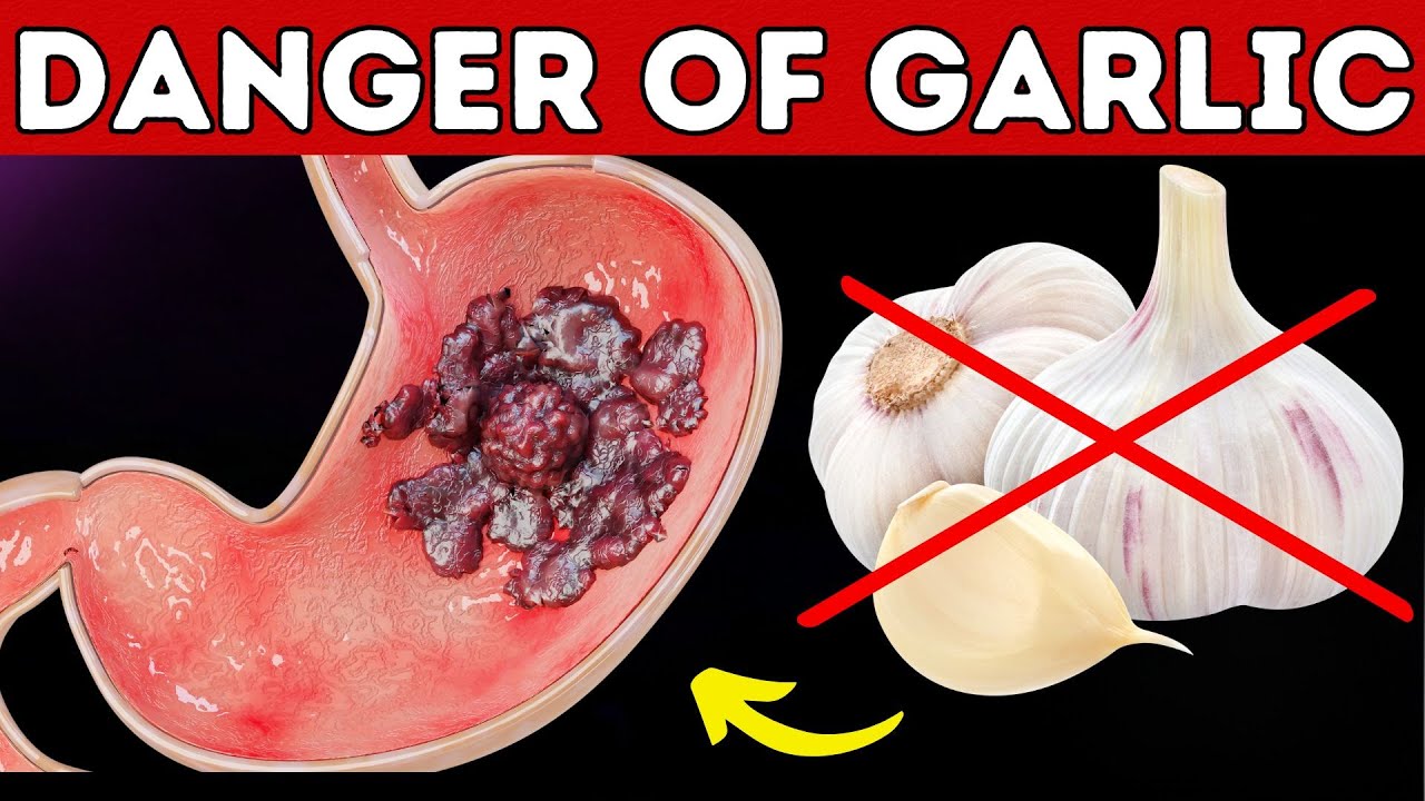 Take Garlic, But Avoid This Common Mistake! | 95% of People Are Unaware