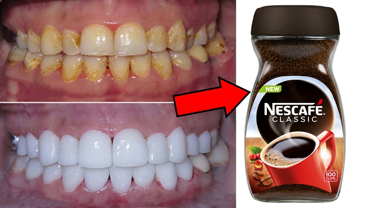 Brighten Your Smile Naturally with Instant Coffee: A Quick and Effective Home Whitening Method