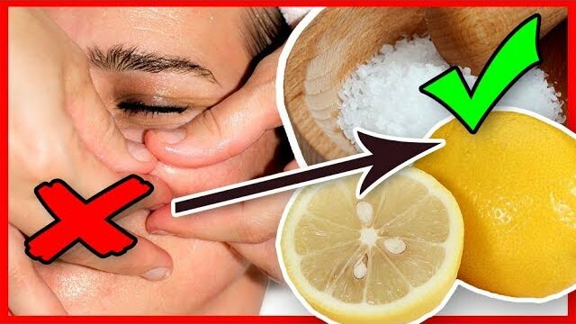 Get Rid of Pimples and Remove Blackheads with a Lemon Salt Scrub Home Remedy