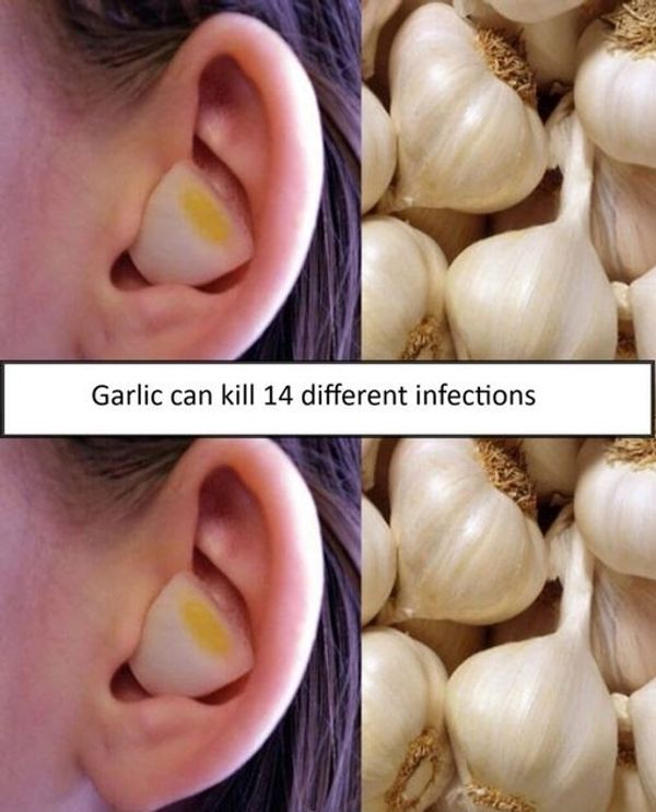 Garlic: The Natural Infection Fighter