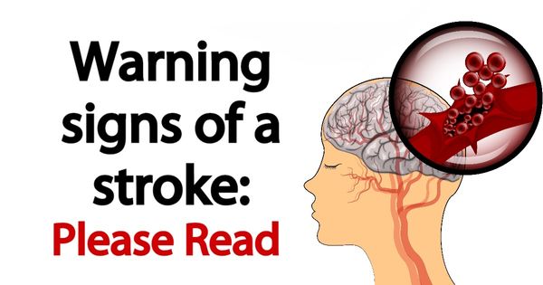 Warning Signs of Stroke – The Life-Saving Information You Need to Know