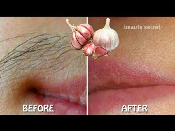 Say Goodbye to Unwanted Hair with Garlic