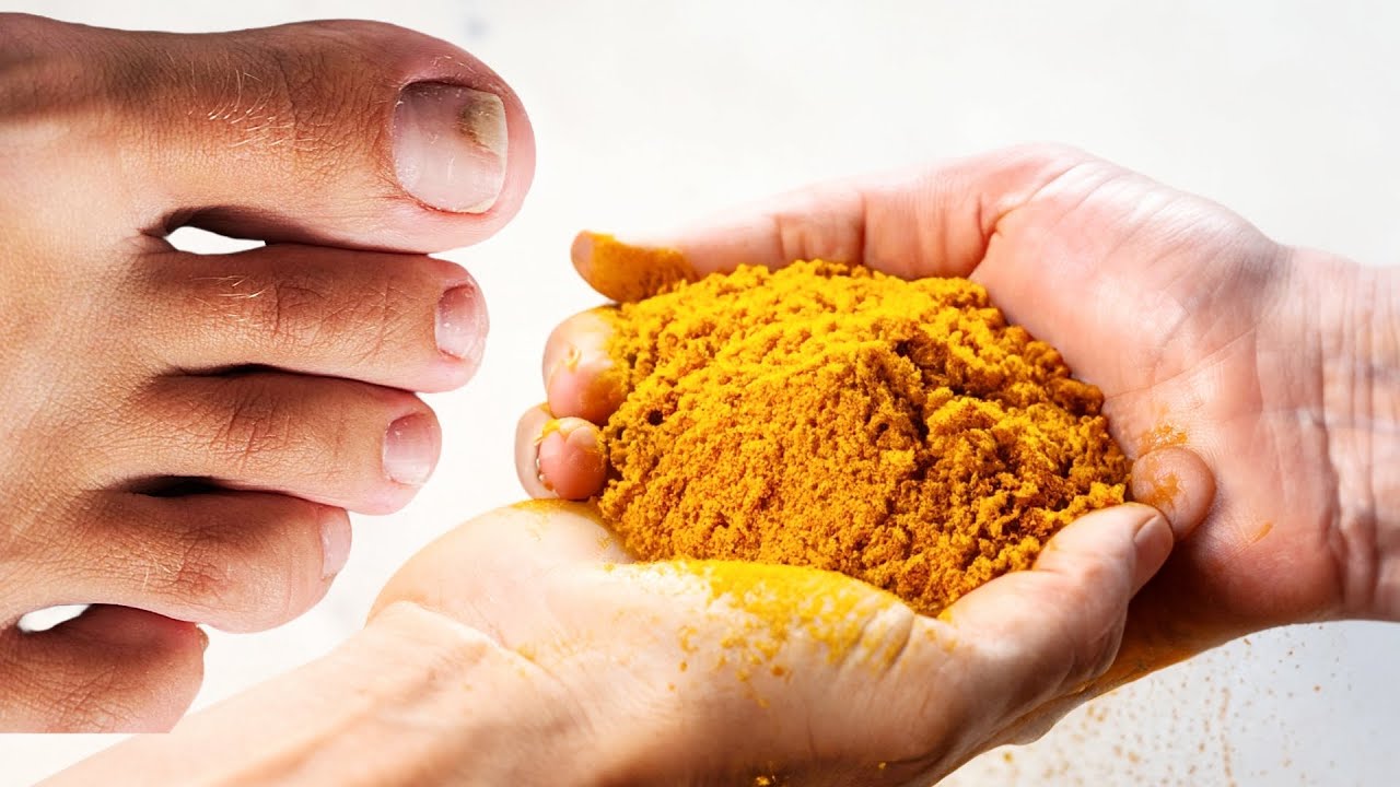 Turmeric: A Powerful Remedy Against Nail Fungus