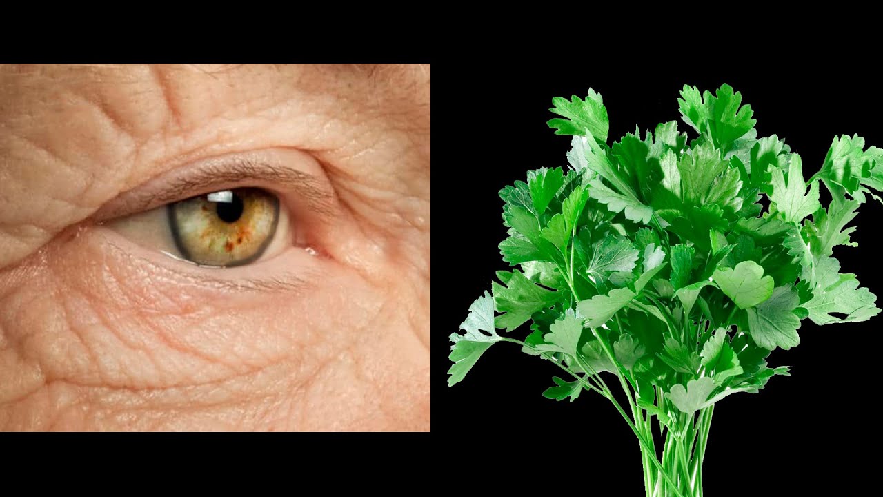 Unbelievable! 🔥 I Have 100% Restored My Vision with This Effective Parsley Drink