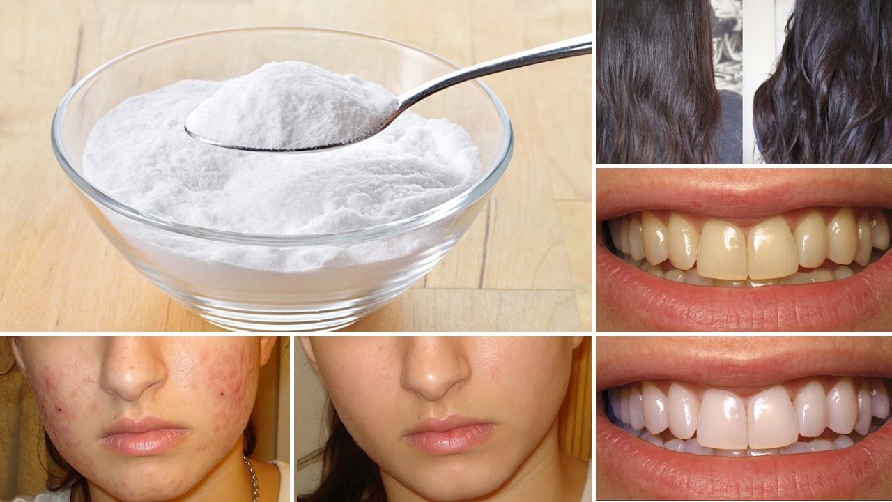 Discover the Versatile Benefits of Baking Soda for Hair, Skin, and Body