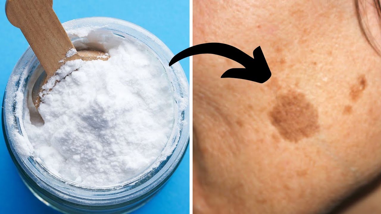 Unlocking the Beauty Benefits of Baking Soda: From Age Spots to Acne