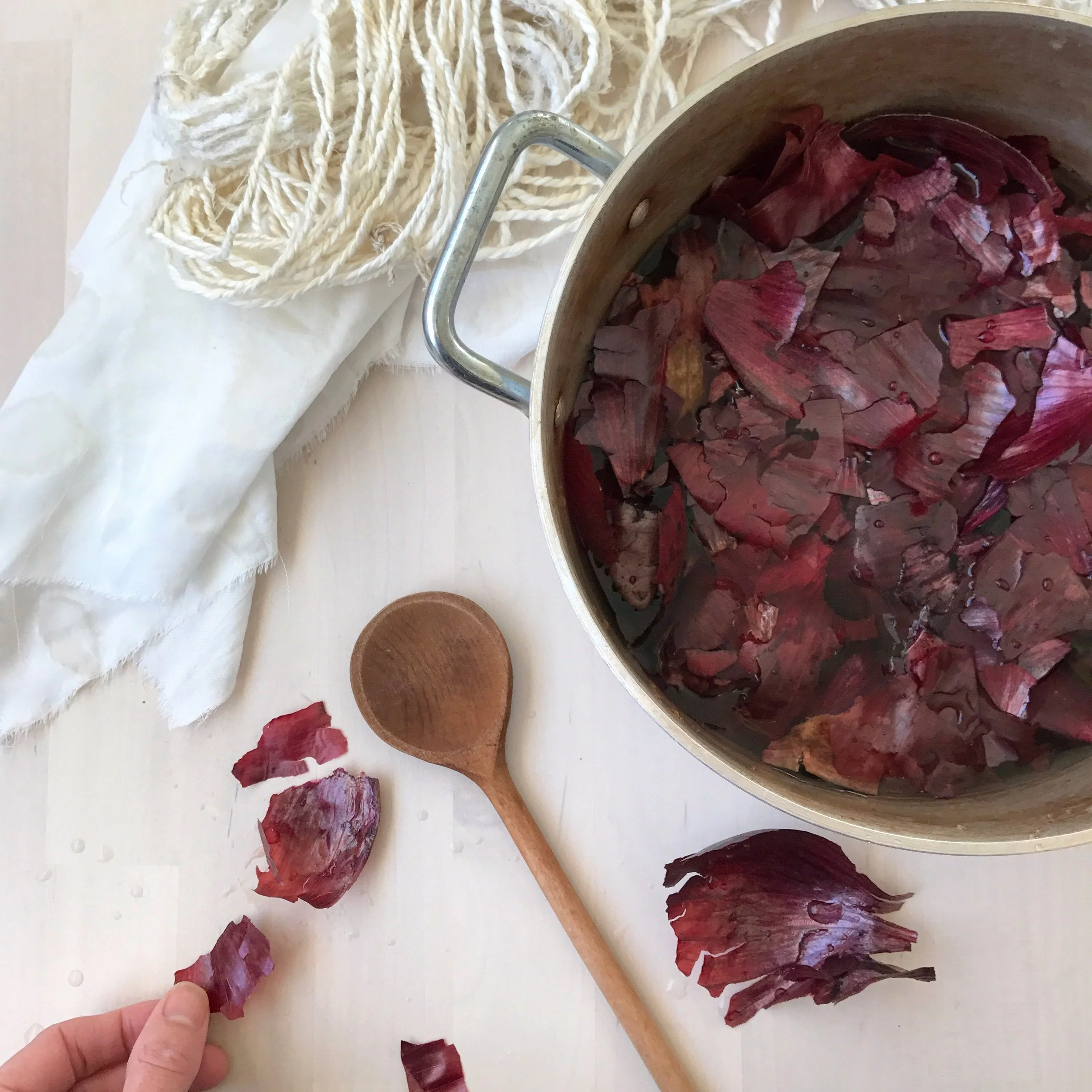 Soothing Varicose Veins with Red Onion Peels: A Simple Home Remedy