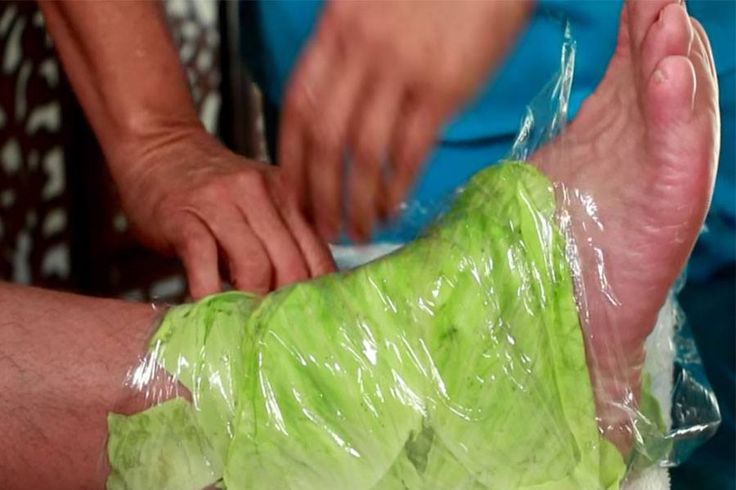 The Healing Power of Cabbage Wraps: A Natural Remedy for Swollen Joints and Thyroid Issues