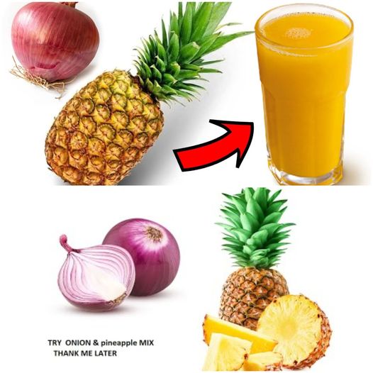 Natural Remedies for Bronchitis: Pineapple and Lemon