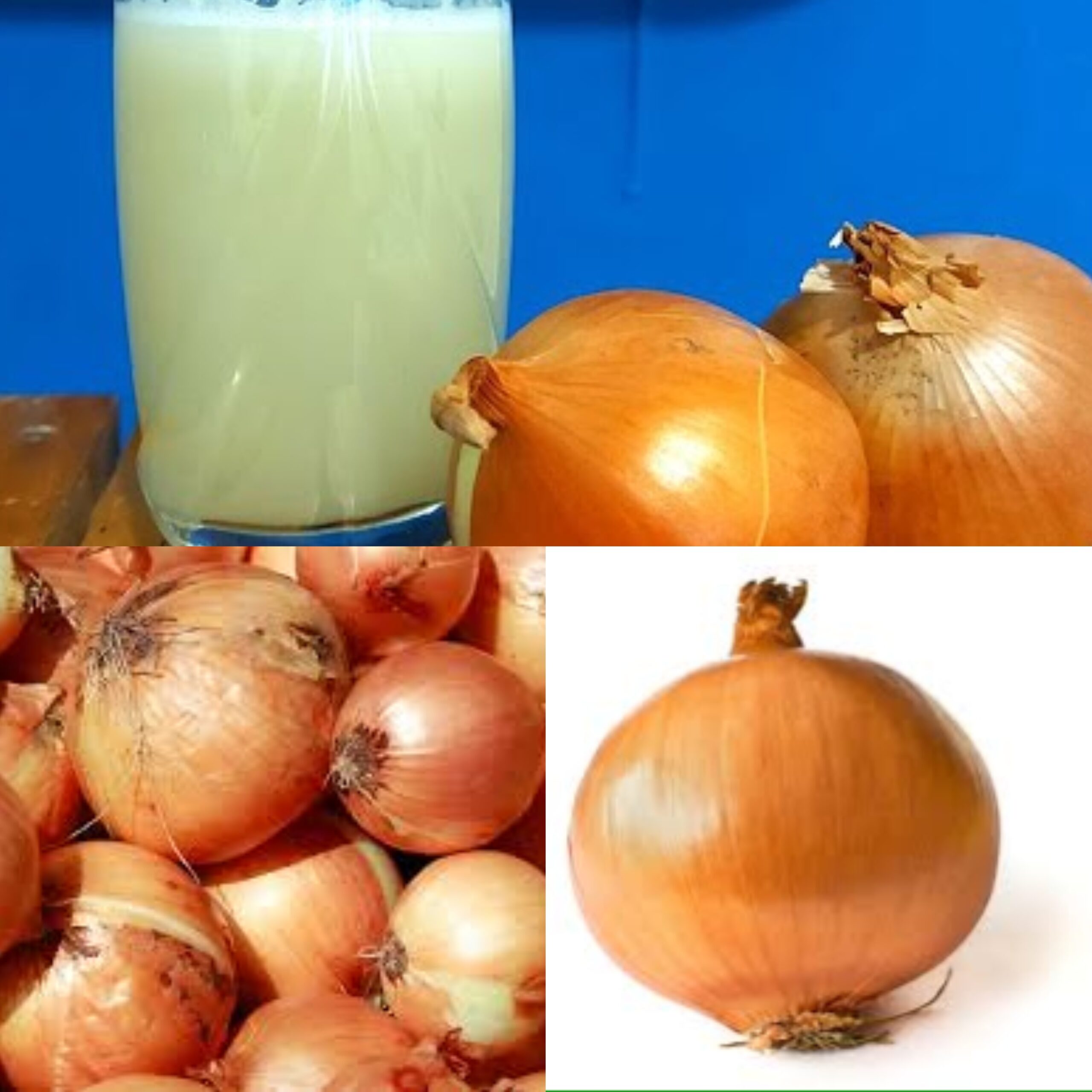 Why Onion Juice May Help Hair Regrowth: