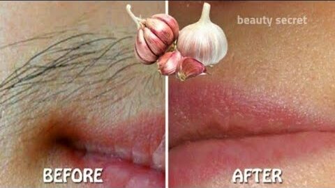 Stop Shaving! Here’s How to Permanently Get Rid of Facial, Body, and Pubic Hair with Garlic