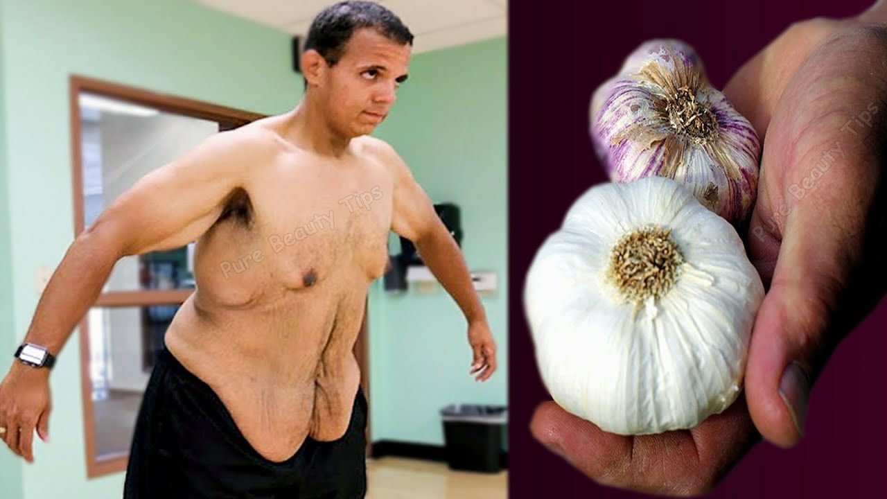 The Power Duo: Garlic and Ginger for Belly Fat Reduction