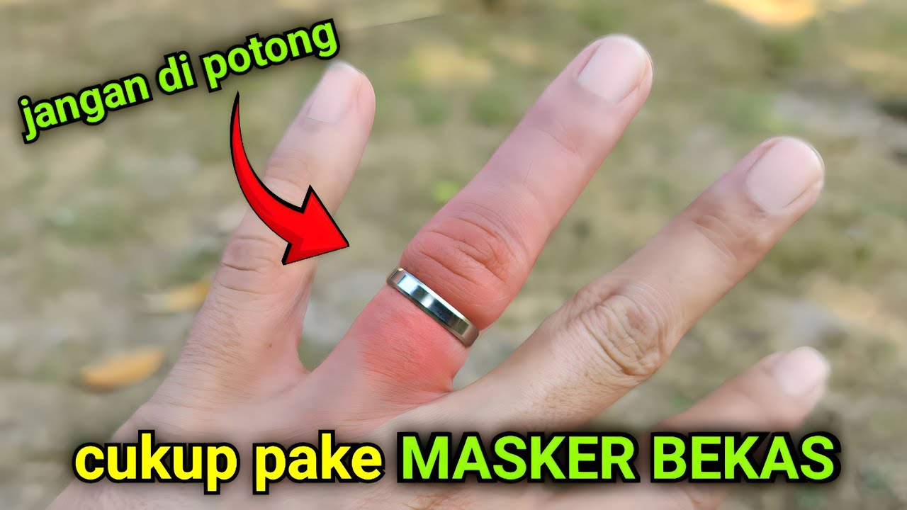 Simple Ways to Safely Remove a Stuck Ring from Your Finger