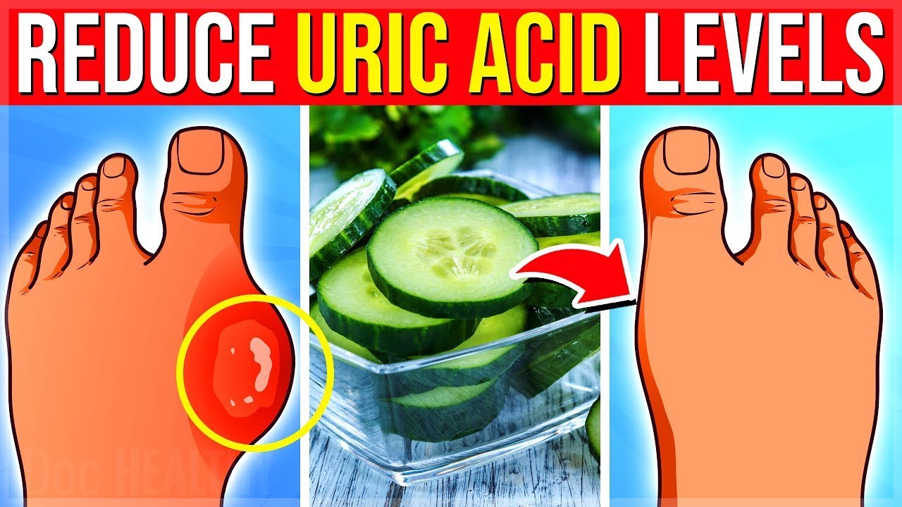 Title: 17 Powerful Superfoods to Help Reduce Uric Acid Levels