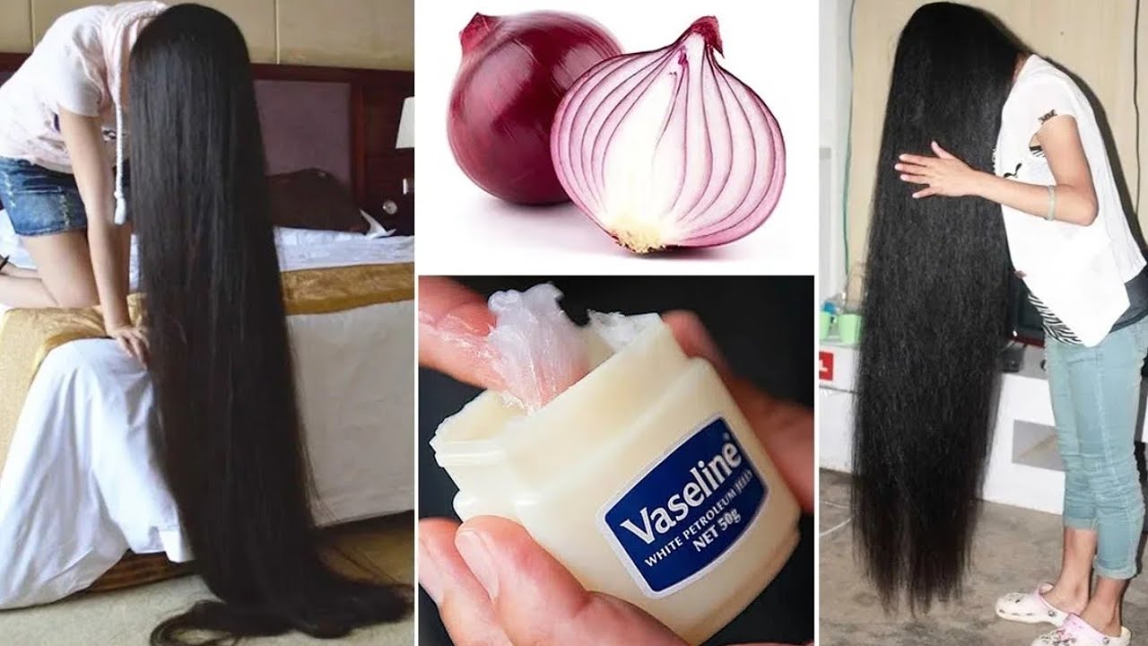 Boost Your Hair Growth with Vaseline and Onion: A Simple Home Remedy