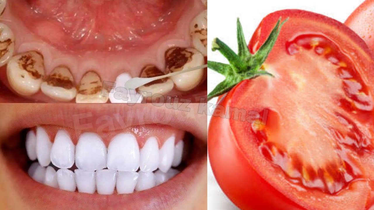 Brighten Your Smile Naturally: Tomato Teeth Whitening