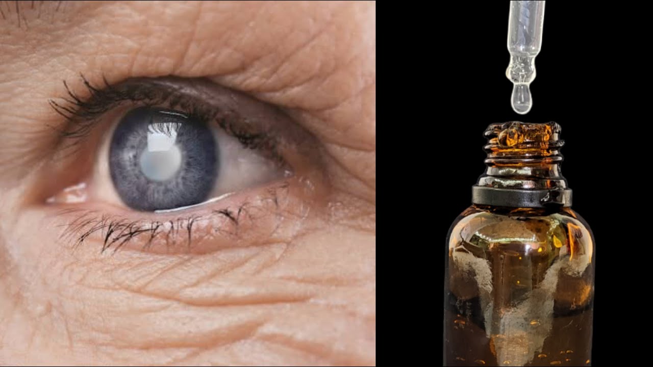 Discover Natural Eye Health: A Simple Solution for Cataracts and Inflammation