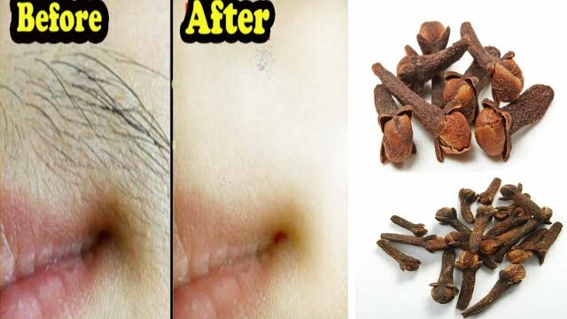 Get Rid of Unwanted Facial and Body Hair Painlessly in Just 5 Minutes