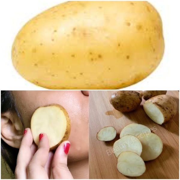 **Discover the Power of Potatoes for Your Skin!**