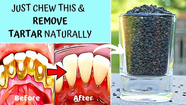 Natural Ways to Maintain a Healthy Smile