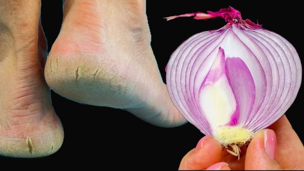 **Why Red Onion?**