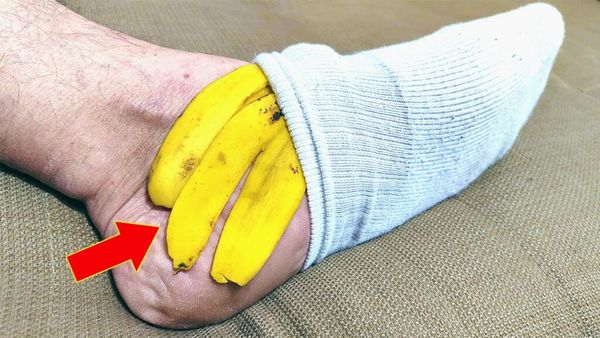 Banana Peels: The Secret to Healthy and Happy Feet