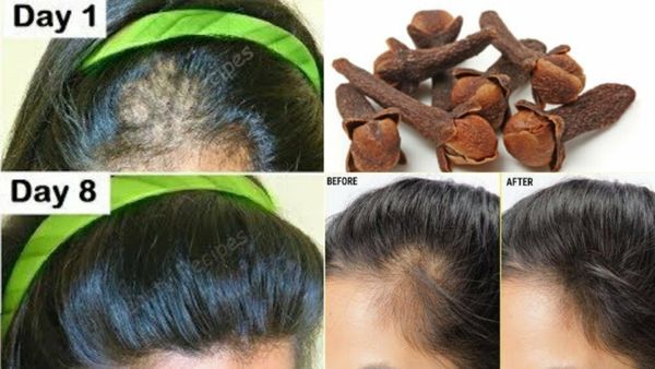 Discover the Indian Secret for Rapid Hair Growth with Cloves