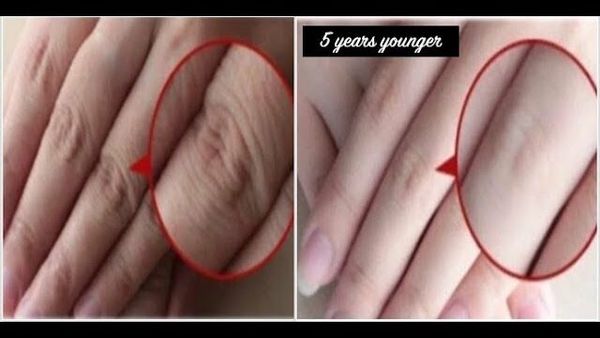 Achieve Younger-Looking Hands Overnight