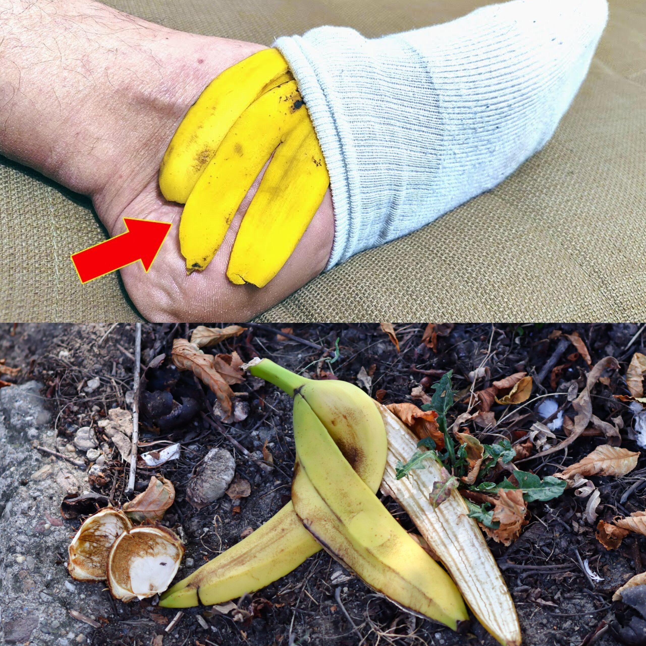 Put Banana Peel on Your Feet and Don’t Spend More at the Pharmacy (Did You Know That?)